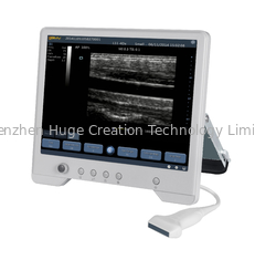 Cina Sistem Ultrasuara Diagnostik Digital TS20 untuk Departemen Obstetri dan Ginekologi pemasok