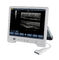 Sistem Ultrasuara Diagnostik Digital TS20 untuk Departemen Obstetri dan Ginekologi pemasok