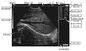 CLS5800 laptop Veterinary Ultrasound Scanner Full Digital Ultrasonic Diagnostic System pemasok