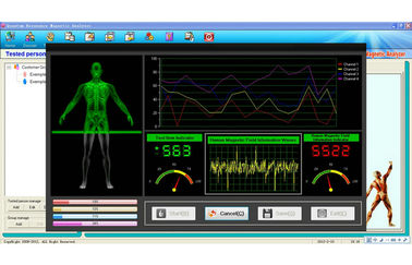 Korea Versi Quantum Magnetic Resonance Kesehatan Analyzer AH-Q8 pemasok